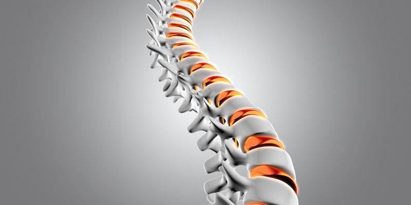 Spine Surgery in India
